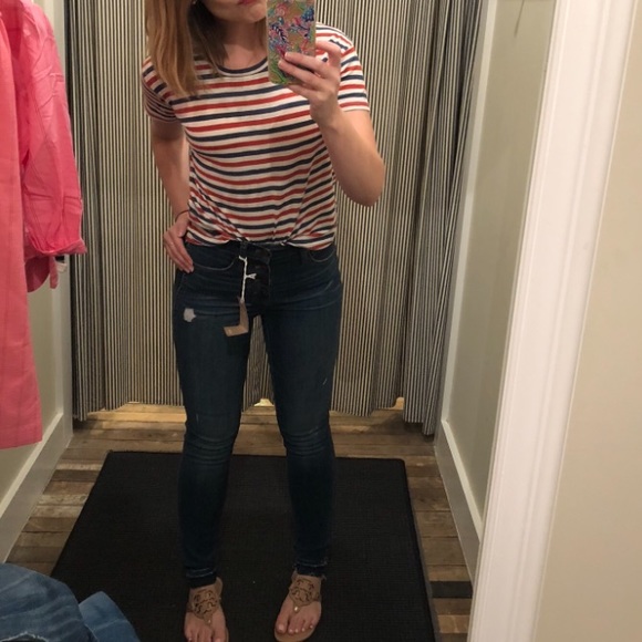 Madewell Denim - Madewell ButtonFly 10” High Rise Distressed Skinny